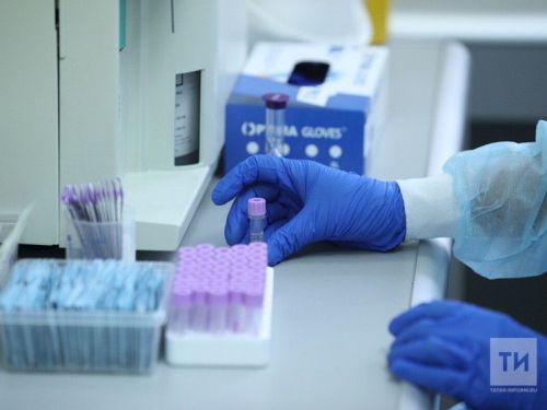 В Татарстане растёт заболеваемость ВИЧ-инфекцией