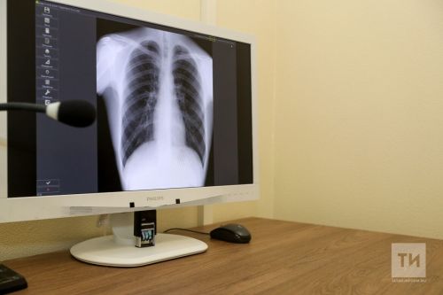 Флюорография үтүдән баш тартмагыз