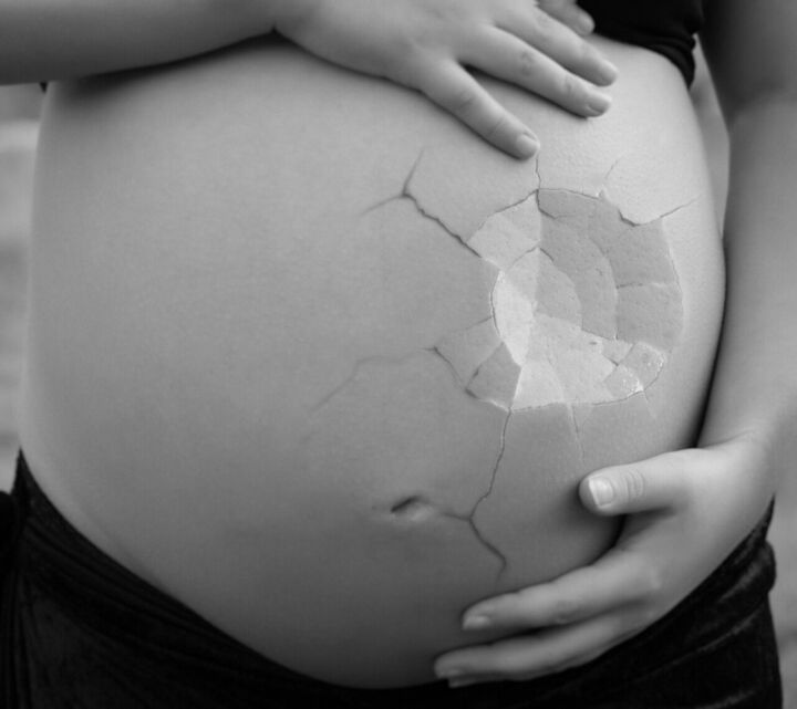 От коронавируса в Татарстане скончались 6 беременных женщин